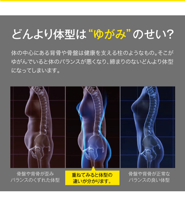 ゆがみ