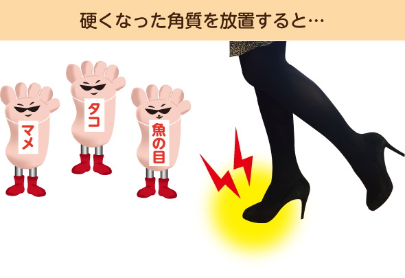 硬くなった角質を放置すると