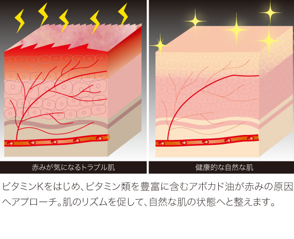 ビタミン類を豊富に含むアボカド油が赤みの原因へアプローチ