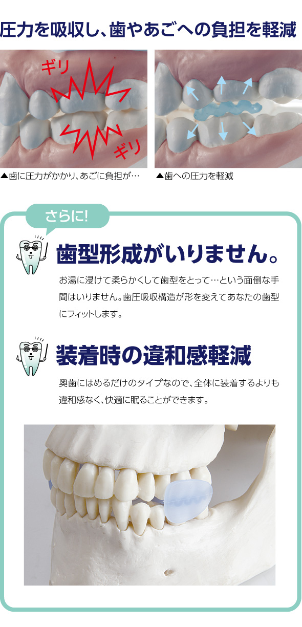 歯型形成いらない・違和感軽減